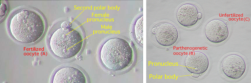 Ivf oocyte mature multiple pn